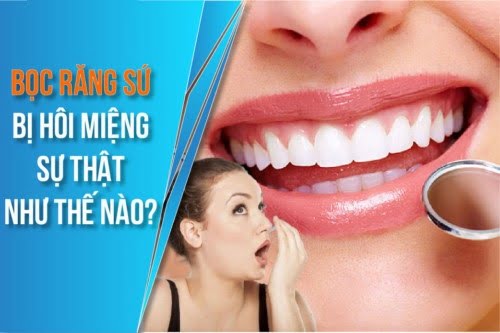 Bọc Răng Sứ bị Hôi Miệng là do đâu?