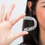 Niềng răng trong suốt: tất tần tật những điều bạn cần phải biết