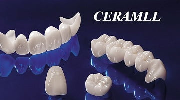 rang-su-Ceramill