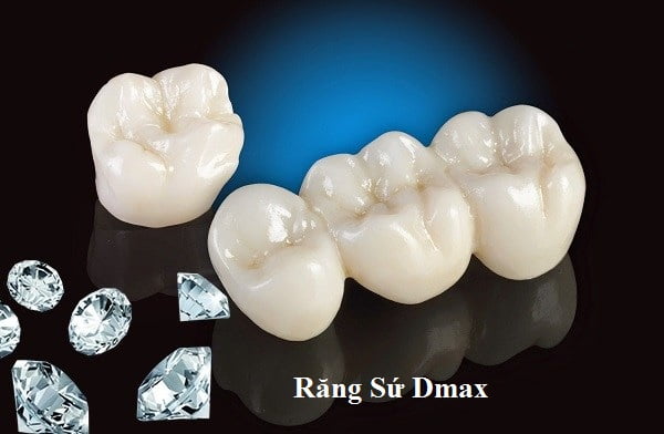 rang-su-dmax-kim-cuong