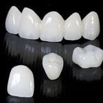 Bọc răng sứ Zirconia có tốt không? Có mấy loại và giá bao nhiêu?