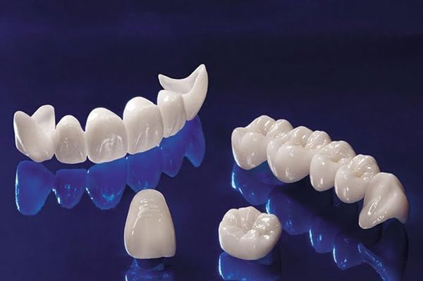 rang-su-zirconia