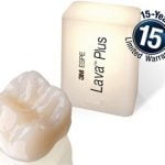 Giới thiệu về răng sứ Lava Plus Mỹ và những ưu điểm nổi bật