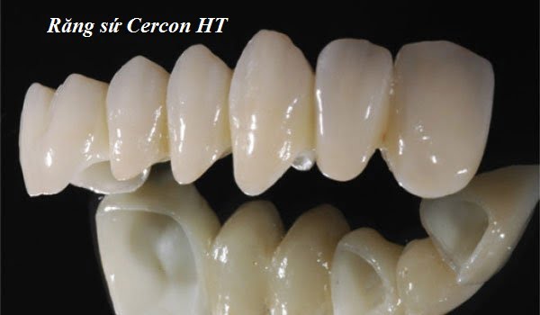 boc-rang-su-cercon-ht