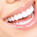 Có nên bọc răng sứ nguyên hàm không? Những điều cần phải biết