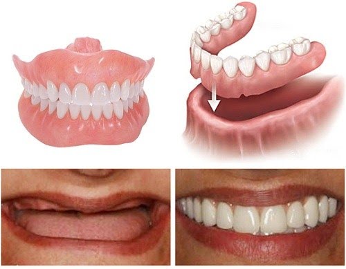 phuc-hinh-thao-lap-toan-ham