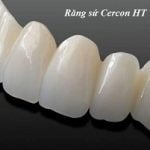 Răng sứ Cercon HT là gì? Có tốt không? Bọc hết bao nhiêu tiền?