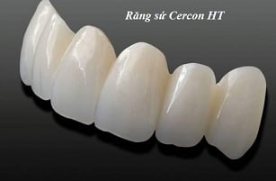 rang-su-cercon-ht