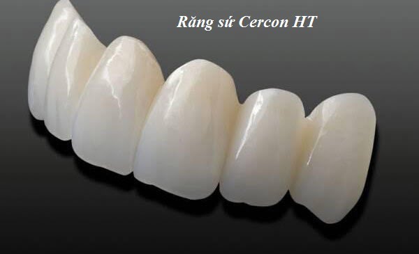 rang-su-cercon-ht