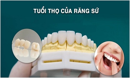 boc-rang-su-co-tot-khong1