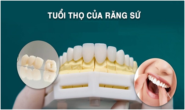 boc-rang-su-co-tot-khong1