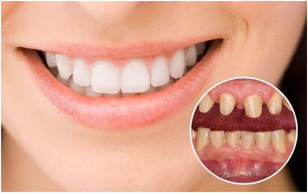 boc-rang-su-co-tot-khong3