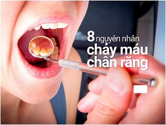 chay-mau-chan-rang-la-gi1