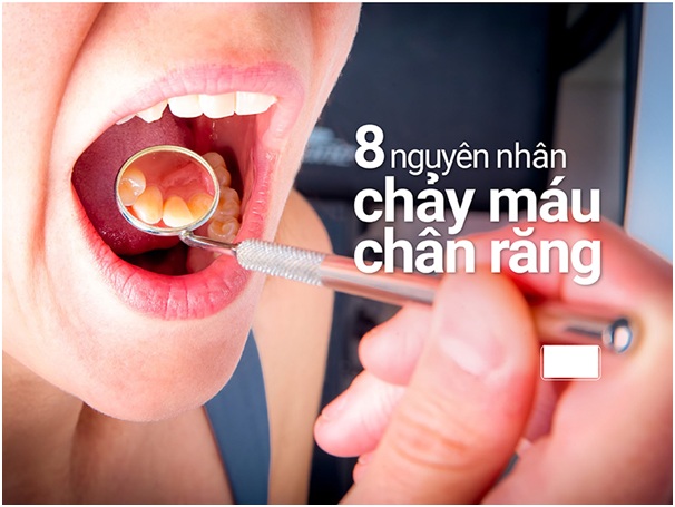 chay-mau-chan-rang-la-gi1