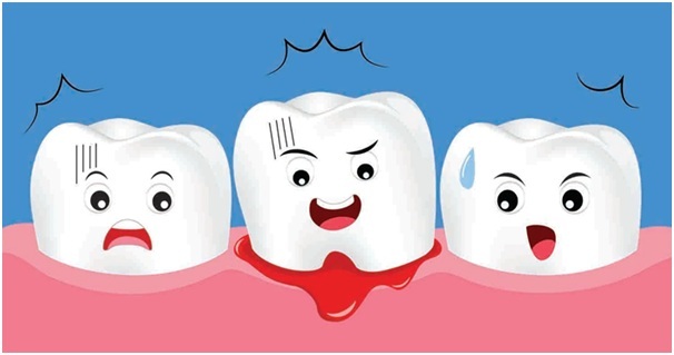 chay-mau-chan-rang-la-gi2