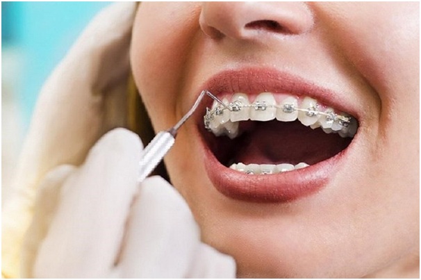 nieng-rang-cho-tre-em3