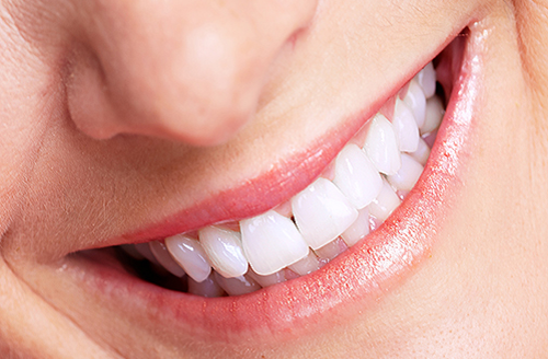 boc-rang-su-gia-bao-nhieu