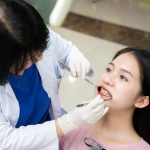 Niềng răng 24 tuổi: Có nên thực hiện và những thông tin cần biết