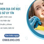 Địa Chỉ Bọc Răng Sứ Hà Nội Uy Tín, Có Tâm