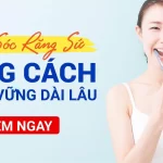 Hướng Dẫn Chi Tiết Chăm Sóc Răng Sau Khi Bọc Sứ