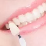 Phương pháp bọc răng sứ thẩm mỹ có hại tới sức khoẻ không?