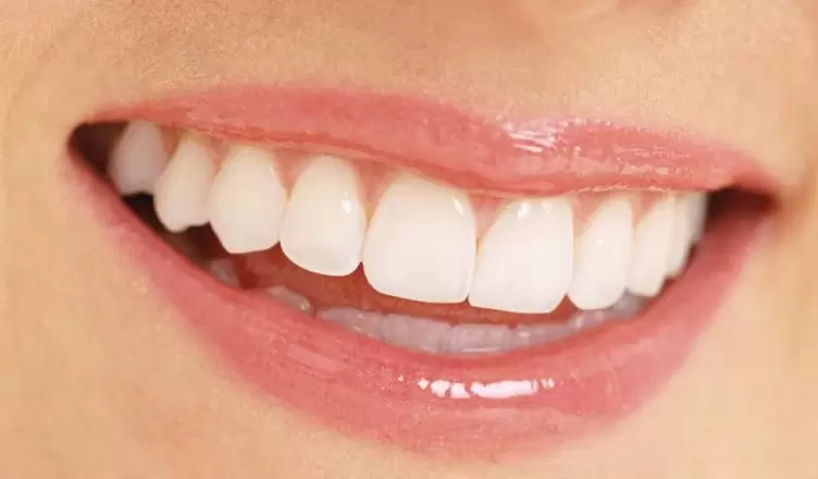 boc-rang-su-ceramill