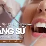 Bọc răng sứ có đau không? Chịu đau kém cũng có thể bọc răng sứ