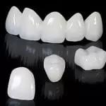 Bọc răng sứ Zirconia có tốt không? Có mấy loại và giá bao nhiêu?
