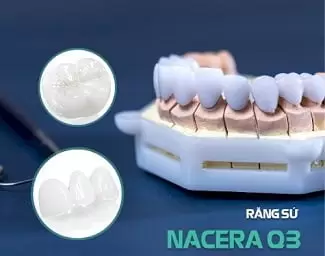 rang-toan-su-nacera-q31