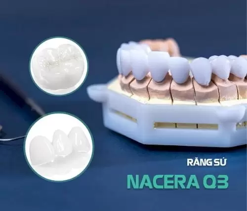 rang-toan-su-nacera-q31