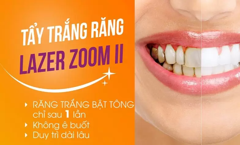 tay-trang-rang-Laser-Zoom-II