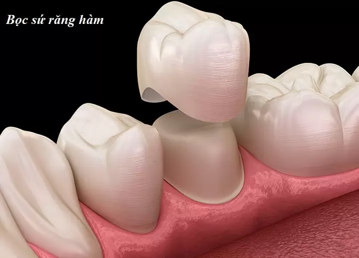 boc-su-rang-ham
