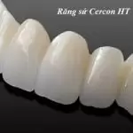 Răng sứ Cercon HT là gì? Có tốt không? Bọc hết bao nhiêu tiền?