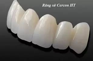 rang-su-cercon-ht