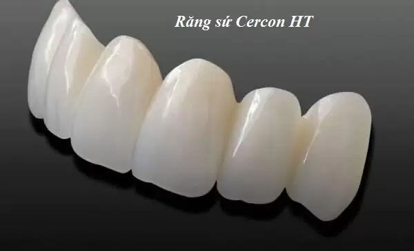 rang-su-cercon-ht