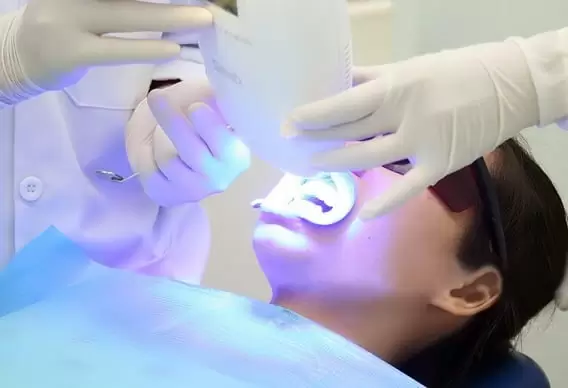 tay-trang-rang-laser