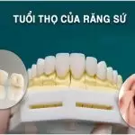 Bọc răng sứ có tốt không? Bọc răng sứ ở đâu uy tín nhất?