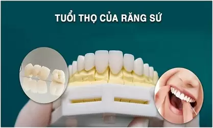 boc-rang-su-co-tot-khong1