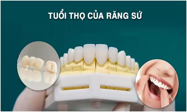 boc-rang-su-co-tot-khong1