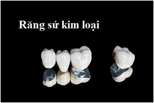 boc-rang-su-va-nhung-thong-tin-can-biet2