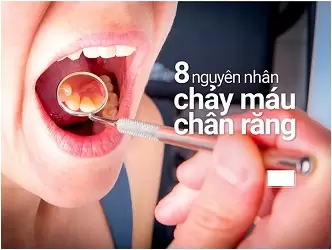 chay-mau-chan-rang-la-gi1