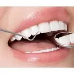 Phương pháp bọc răng sứ thẩm mỹ – Chia sẻ kinh nghiệm từ A đến Z