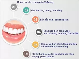 quy-trinh-boc-rang-su-chuyen-nha-khoa2