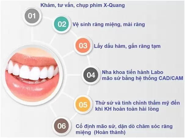 quy-trinh-boc-rang-su-chuyen-nha-khoa2