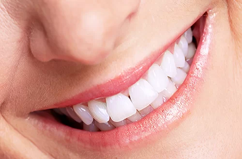 boc-rang-su-gia-bao-nhieu