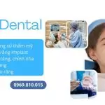 Địa Chỉ Nha Khoa Uy Tín Ở Hà Nội – Chuẩn 10 Điểm